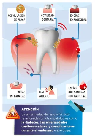 sintomas-dentologies-320x458
